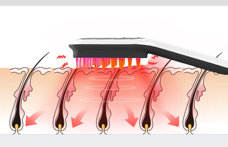 Electric Head Massager Magnetic Therapy Hair Growth Comb Blue Red Light Scalp Massage Brush Relieve Fatigue Pressure LED Display - Chardon Chree Co.